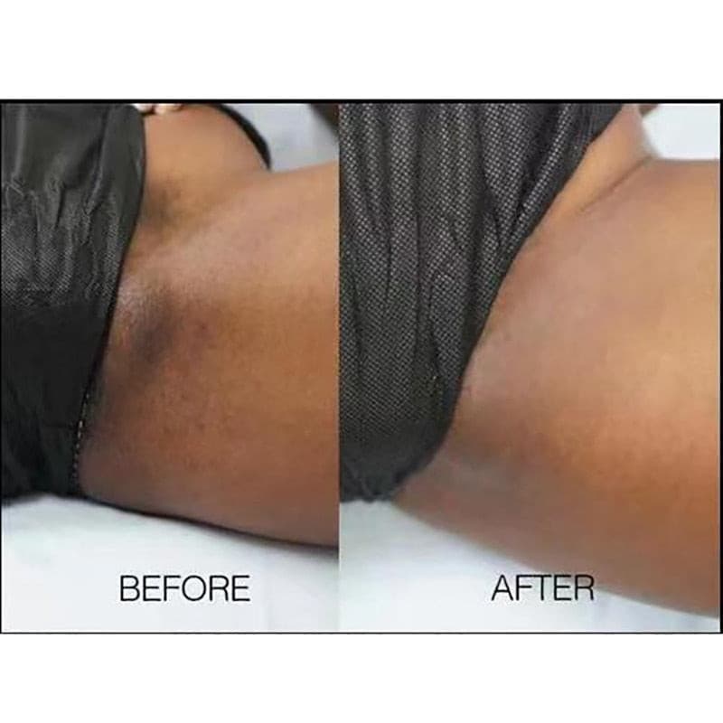 African Nigerian Whitening Soap Vaginal Handmade Soap Dark Bikini Line Women Vaginal Skin Cleansing Rswank